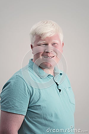 Albino young man portrait. Blond guy isolated at grey background. Albinism Stock Photo