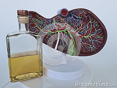Alcoholic liver damage and liver cirrhosis concept with liver and alcohol Stock Photo