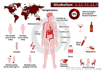 Alcoholism infographic Vector Illustration