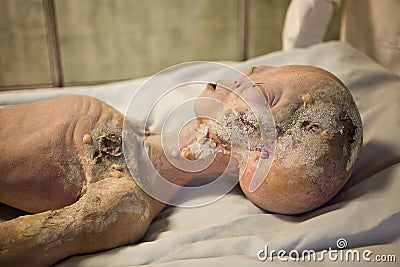 Alien Autopsy Stock Photo