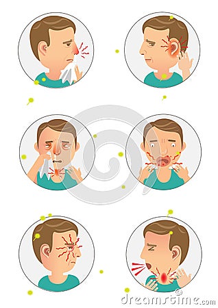 Allergic Vector Illustration