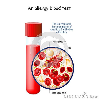 Allergy blood test Vector Illustration