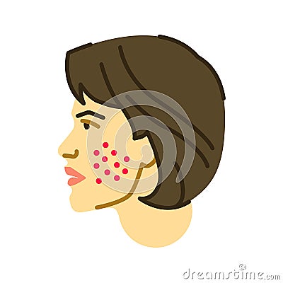 Allergy symptoms flat color icon. Skin rash. Dermatological diseases. Itchy spots on face. Sign for web page, mobile app, button, Stock Photo