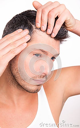 Alopecia male Stock Photo