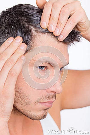 Alopecia male Stock Photo