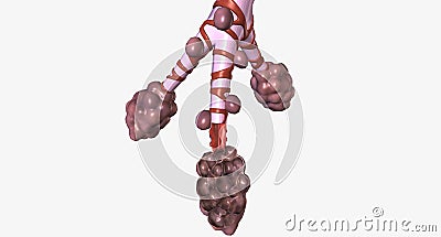 Alveoli and Bronchiole Damage from Smoking Stock Photo