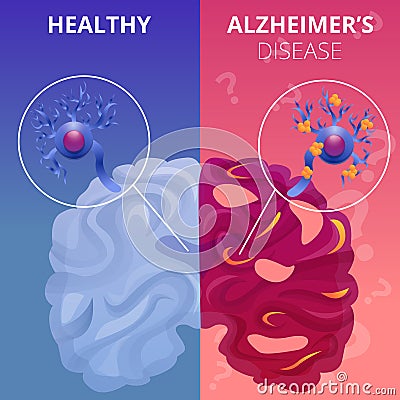 Alzheimer brain banner set, cartoon style Vector Illustration