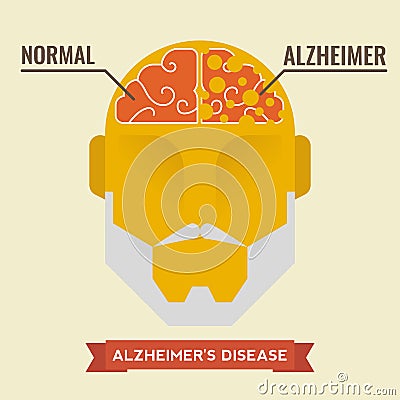 Alzheimer Vector Illustration