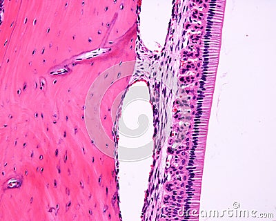 Ameloblasts. Rat tooth Stock Photo
