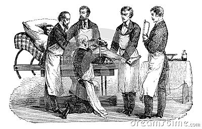 Amputation of the thigh. Positions of the surgeon and assistants, vintage engraving Vector Illustration
