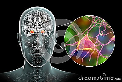 Amygdala in the brain, and closeup view of amygdala neurons, 3D illustration Cartoon Illustration