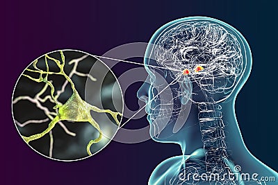 Amygdala in the brain, and closeup view of amygdala neurons, 3D illustration Cartoon Illustration