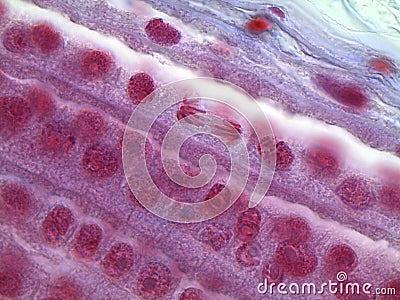 Anaphase of mitotic onion root tip cells under the microscope Stock Photo