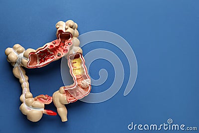 Anatomical model of large intestine on blue background, top view with space for text. Gastroenterology Stock Photo
