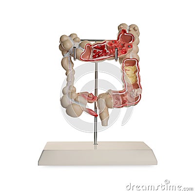 Anatomical model of large intestine isolated on white. Gastroenterology Stock Photo