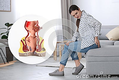 Anatomical model of rectum with hemorrhoids. Young woman suffering from pain at home Stock Photo