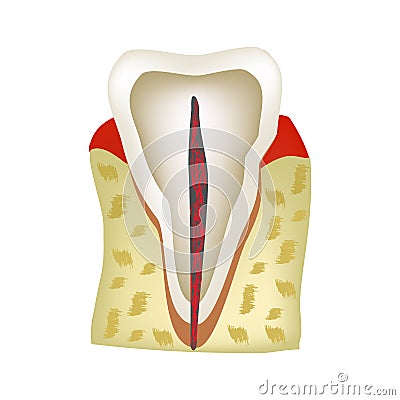 The anatomical structure of the tooth. Infographics. Vector illustration on isolated background Vector Illustration