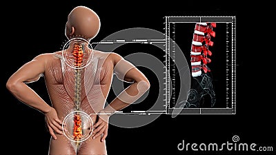Anatomical vision back pain. Spine anatomy. 3D illustration Stock Photo