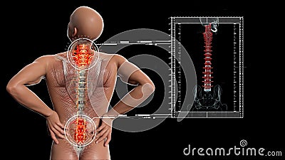 Anatomical vision back pain. Spine anatomy. 3D illustration Stock Photo