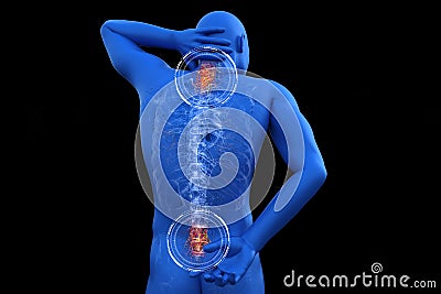 Anatomical vision back pain. Spine anatomy. 3D illustration Stock Photo