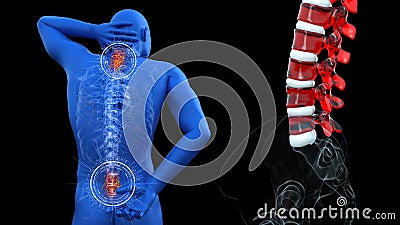 Anatomical vision back pain. Spine anatomy. 3D illustration Stock Photo