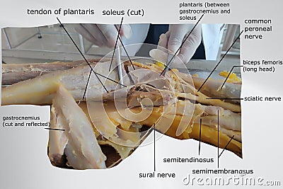 anatomy of superficial flexor muscles of the back of the leg with popliteal fossa Stock Photo