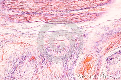 Histological Bone, Elastic cartilage human and Joint of human foetus under the microscope for education. Stock Photo