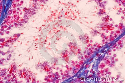 Histological Epididymis and Testis human cells under microscope. Stock Photo