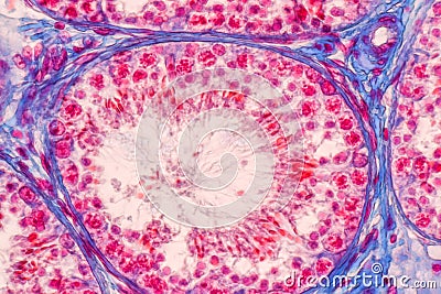 Histological Epididymis and Testis human cells under microscope. Stock Photo