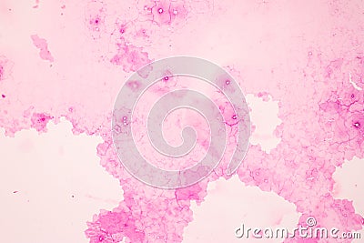Histological Ovary, Testis and Sperm human cells under microscope. Stock Photo