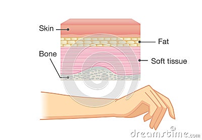 Anatomy of Human Skin layer and arm. Vector Illustration