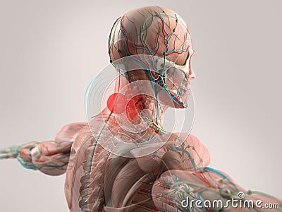 Anatomy model showing neck pain. Stock Photo