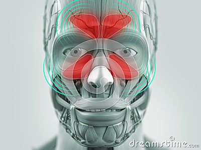 Anatomy model showing sinus infection. Stock Photo