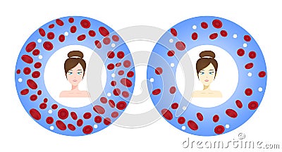 Anemia vector / blood anatomy concept women face Vector Illustration