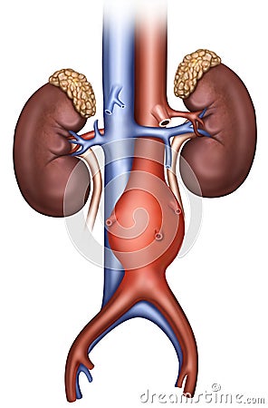 Aneurisma aÃ³rtico abdominal Stock Photo