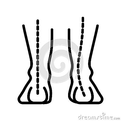 Ankle arch, human foot pathology isolated line icon Vector Illustration