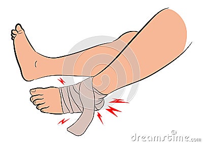 Ankle bandage because of Ligament in the injured ankle, graphics design vector illustration on white background Cartoon Illustration