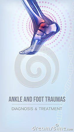 Ankle and foot traumas banner Vector Illustration