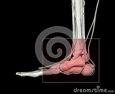 Ankle Injury Stock Photo