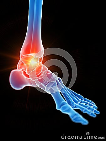 the ankle joint showing pain Cartoon Illustration