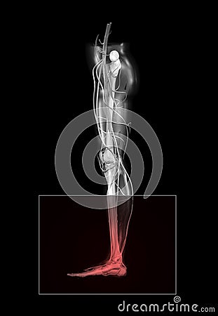 Ankle and Leg Pain Stock Photo