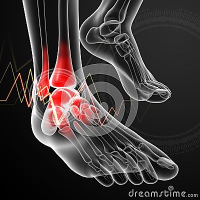 Ankle pain Cartoon Illustration