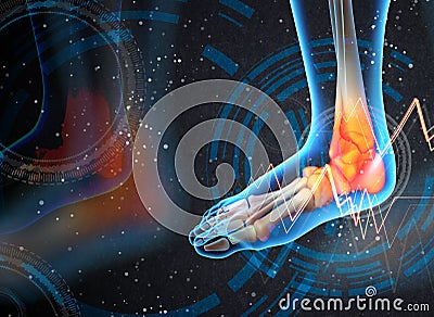 Ankle pain - detail Cartoon Illustration