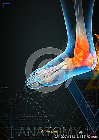 Ankle pain by x- ray on background Cartoon Illustration