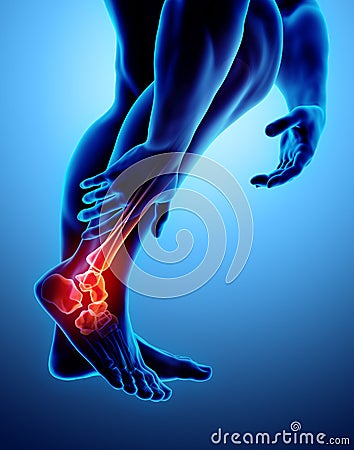 Ankle painful - skeleton x-ray. Stock Photo