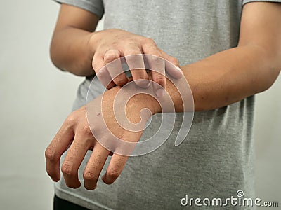 Anonymous man feel itchy, scratching his hand in pain Stock Photo