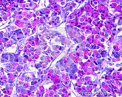 Anterior pituitary. Gomori trichrome stain Stock Photo