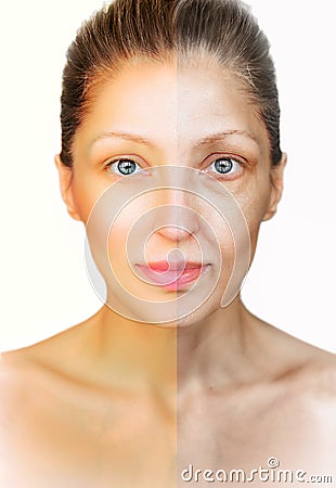 Anti-aging procedure before and after Stock Photo