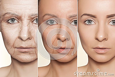 Anti-aging procedures on caucasian woman face Stock Photo