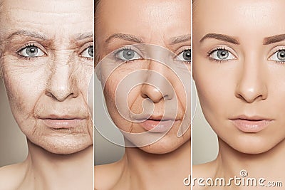 Anti-aging procedures on caucasian woman face Stock Photo